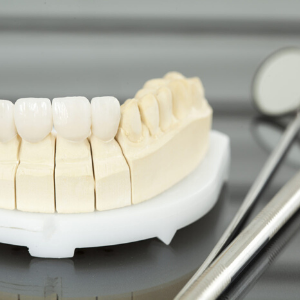 Dental Restorations Manhattan dental